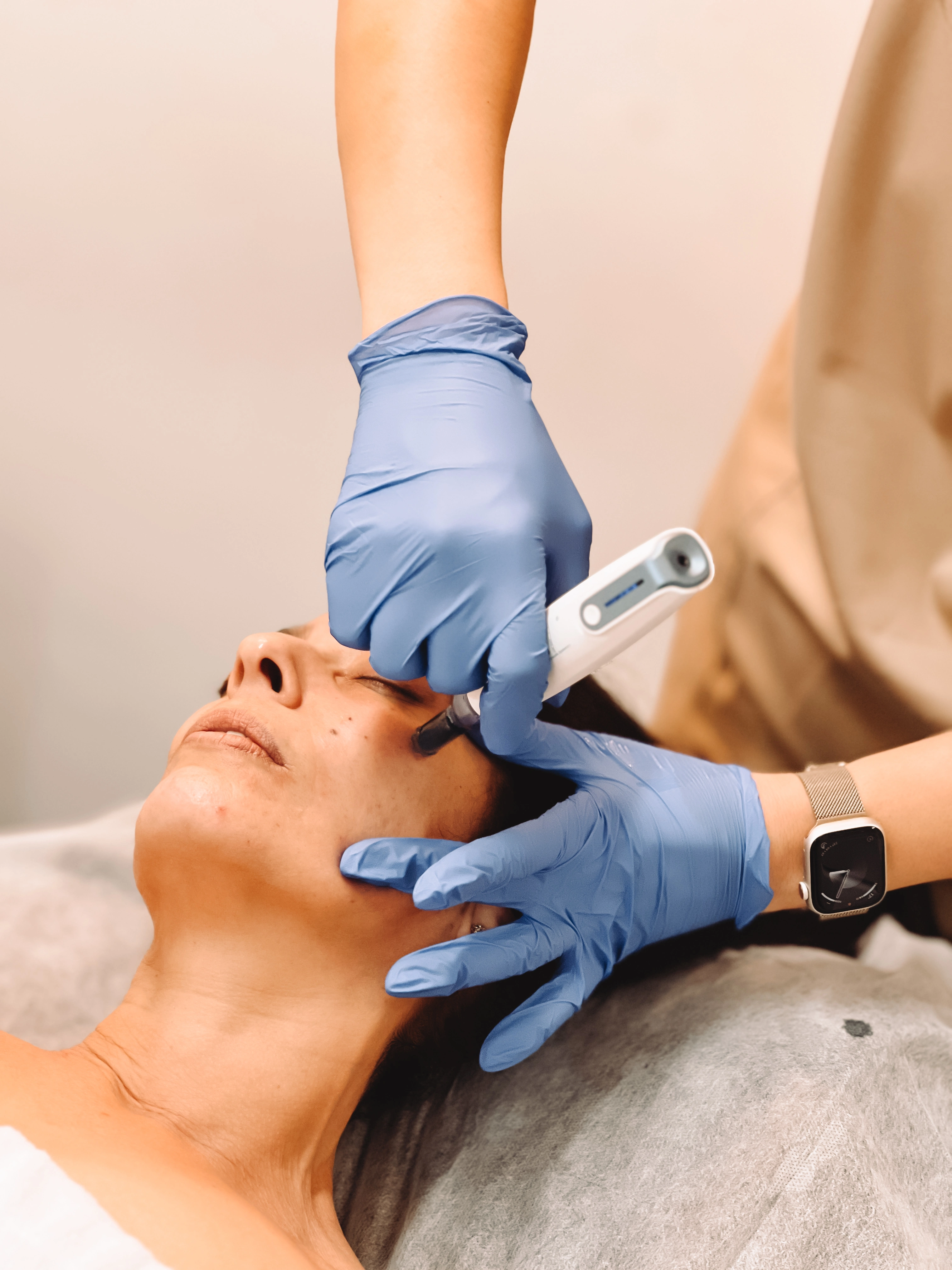 Advanced skin treatments — peels, facials, microneedling